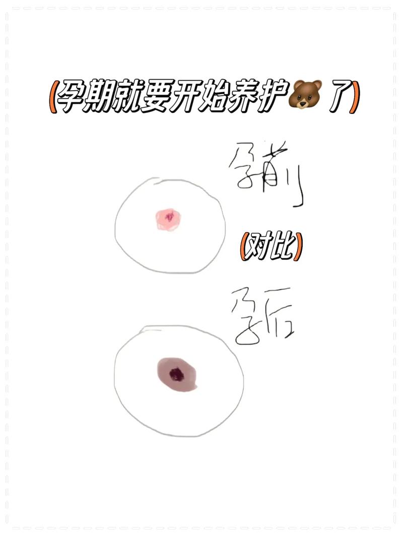孕妈习惯救宝宝一命,孕妇为了救孩子
